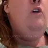 TheCandiceHuffDoubleChinSkin - @candicehufdoublechinskin - TikTok