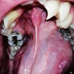 Carl-Moses - @carl_moses_mahn - Instagram