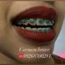 Carmen Brace Installer - Facebook