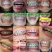 Gie Carmen Brace - Facebook