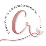 Carmen | Alopecias | Disfunções | Patologias | Autoimunes - @carmenroberta_terapiacapilarbv - Instagram