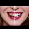Caroline Charles - @caroline.charles8 - TikTok
