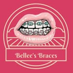 Bellee's Braces - @casandra_rossy22 - Instagram