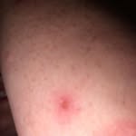 Casey Chiggers - @casey_northup - Instagram