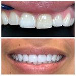 Chad Gardner, DDS - @dental3dprinting - Instagram