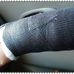 Fox Chase, Temple University BMT at Jeanes Hospital Inpatient - Facebook