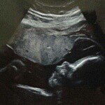 Cherrie Anne King- Manalo - @cherrieanne03 - Instagram