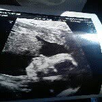 Chris bebout - @peanut8910 - Instagram