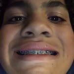 Chris Lanser - @chrisisthebomb.com96 - Instagram