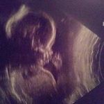 Chrissy Nelson - @ilovehimanjourney - Instagram
