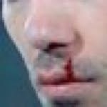 Clint Dempsey's Nose - @clintdempseysnose - Instagram
