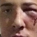 Collin Best - @tripledznuts - Instagram
