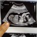 Colton Allen - Facebook