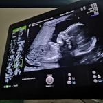 Connor Randall - @connor.randall.90 - Instagram