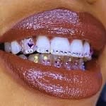 Dallas Teeth Whitening + Gems - @extraordinairexteeth - Instagram