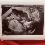 Daniel Haworth - @dogmandan2812 - Instagram