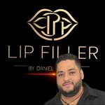 Daniel Molina - @lip_filler_bydanielmolina - Instagram