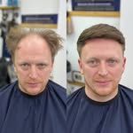 daniel payne - @dans_hairloss_journey - Instagram
