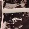 Danielle Blanton - @danielle.blanton5 - TikTok