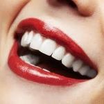 Danielle Nuss - @teethwhitening_bydanielle - Instagram