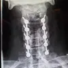 Dave Cochrane - @fracturedfemur - TikTok