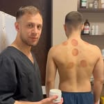 Массаж Хиджама Тюмень - @_daviddavidovich_ - Instagram