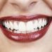SmileDental - Dr. David A. Killen, DDS, PS - Facebook