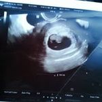 David woolf - @woolf565 - Instagram