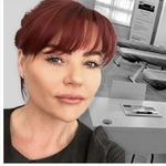 Dawn ONeill Aesthetics Practitioner - @dawnonlaesthetics - Instagram
