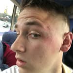 Dawson Hicks - @lumpz4dayz - Instagram