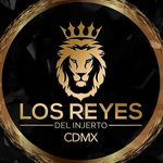 Los Reyes del Injerto CDMX🌟| Injerto Capilar - @reyesdelinjertocdmx - Instagram