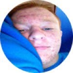 Derrick Akers - @datgingyfella - Instagram