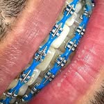 @don_bracesja - Instagram