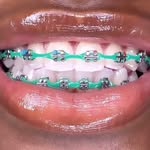 Smile_more😀 - @don__bracesja - Instagram