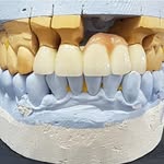 Առամնատեխնիկական լաբորատորիա - @don_dental_labaratoria - Instagram