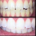 Donna Mclaughlin - @nydiamondsmile - Instagram