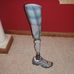Drew Wall's titanium leg - Facebook
