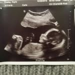 Dwight Ballboy - @dwightballboy - Instagram