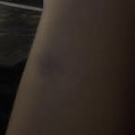 dylan gelula’s bruise - @dylangelulasbruise - Instagram