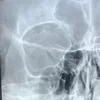 Earl Rodriguez - @orlydominique - TikTok