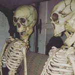 Edith and Lewis - @skeletwins - Instagram