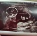 Edward Eason - Facebook