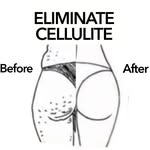 Eliminate Cellulite 🍊🙅 - @eliminatecellulite - Instagram