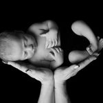 Ellie Brackett👣 - @babyb_ukmk_clubfoot - Instagram