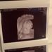 Emily Crum - Facebook