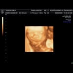 Emily Renee - Facebook