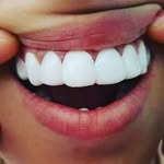 Emmadental - @emma_dental - Instagram