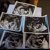 emma - @emmasteenpregnancy - TikTok