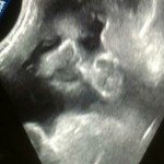 enrique cisneros - @enriquecisneros15 - Instagram