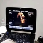 Ercilia Castro - @ercilia263 - Instagram